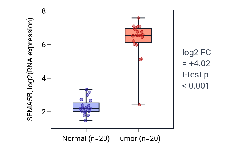 Tumor-vs-normal expression box plot for SEMA5B in KIRC.