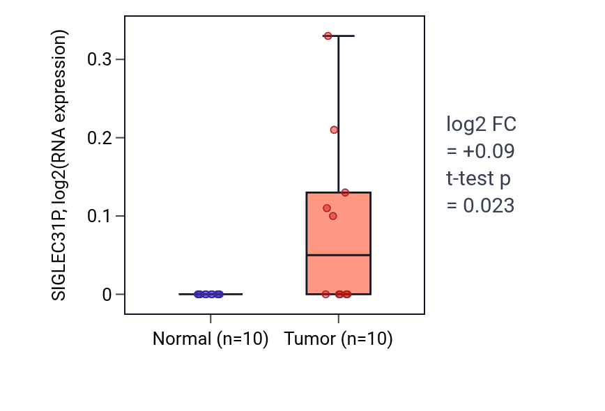 Tumor-vs-normal expression box plot for SIGLEC31P in KIRP.