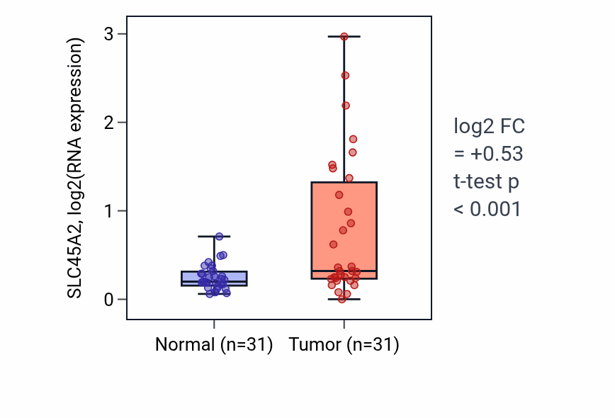 Tumor-vs-normal expression box plot for SLC45A2 RNA in KIRP.