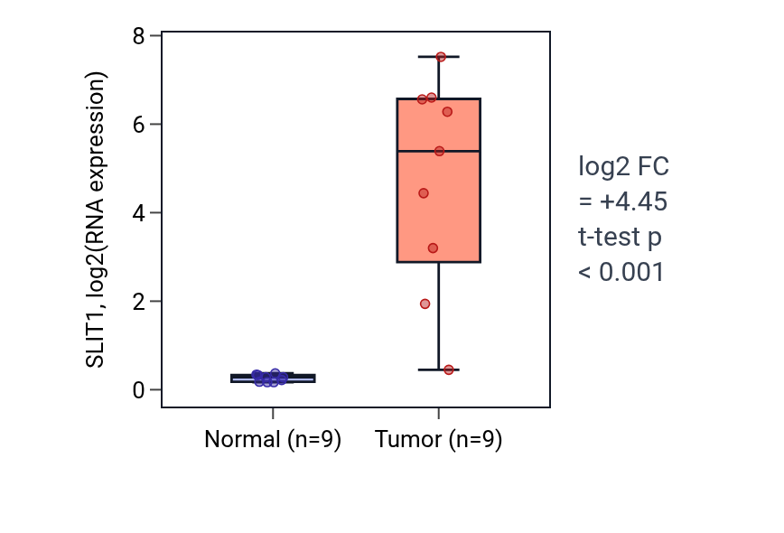 Tumor-vs-normal expression box plot for SLIT1 in THCA.