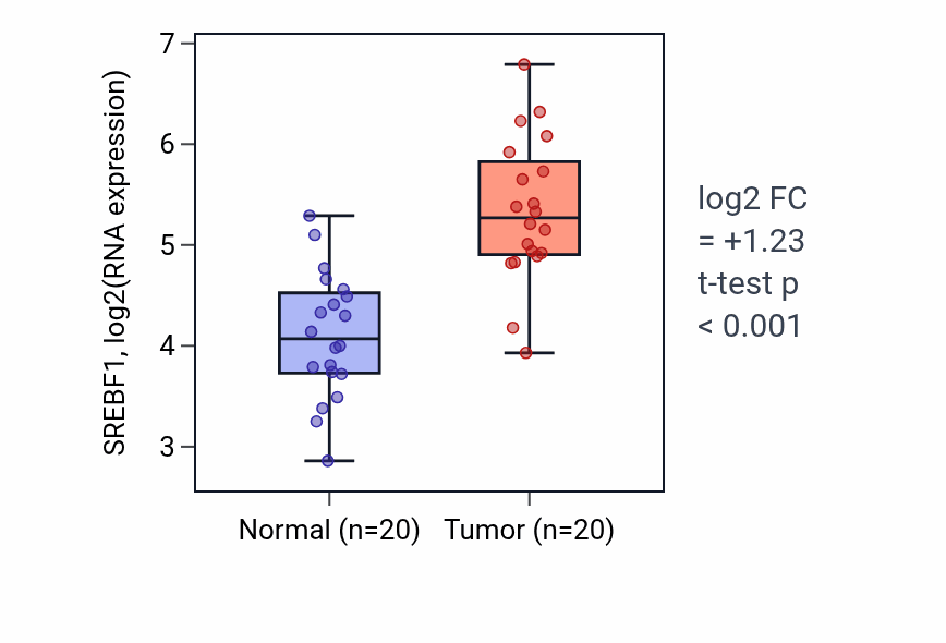 Tumor-vs-normal expression box plot for SREBF1 RNA in KIRC.
