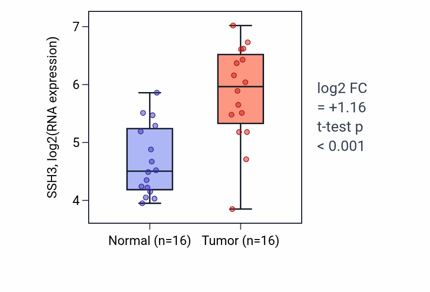 Tumor-vs-normal expression box plot for SSH3 RNA in KIRP.