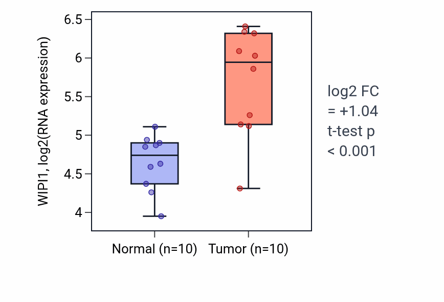 Tumor-vs-normal expression box plot for WIPI1 RNA in KIRP.