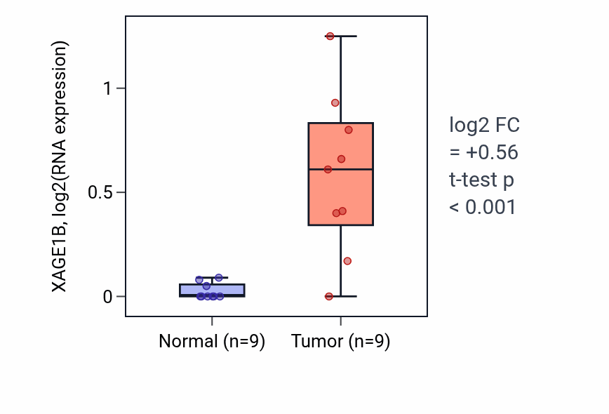 Tumor-vs-normal expression box plot for XAGE1B in LUAD.