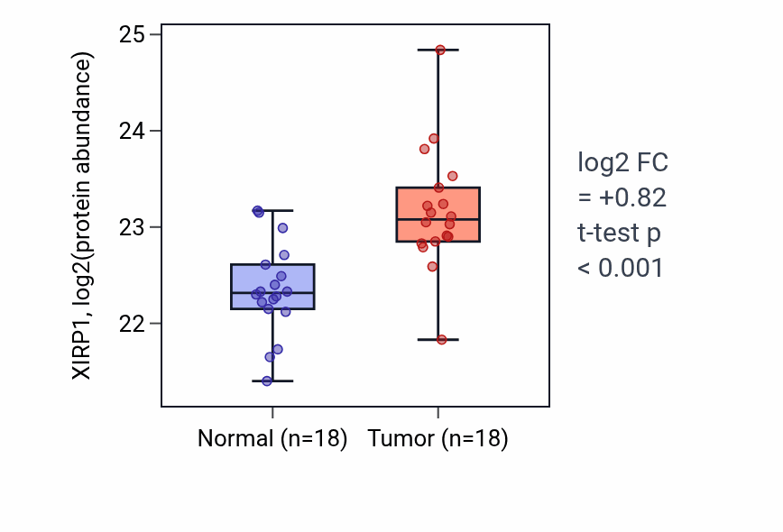 Tumor-vs-normal mass-spec protein box plot for XIRP1 in PDAC.